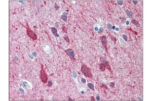 Human Brain, Cortex: Formalin-Fixed, Paraffin-Embedded (FFPE)