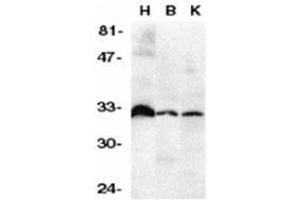 Western blot analysis of DcR3 in human heart (H), brain (B), and kidney (K) tissue lysates with AP30281PU-N DcR3 antibody at 1/500 dilution.