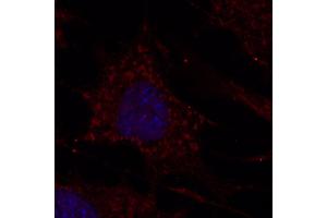 Immunofluorescence - anti-CTSD Ab at 1/100 dilution in NHI/3T3 cells, cells were fixed with methanol and permeabilized With 0. (Cathepsin D antibody  (C-Term))