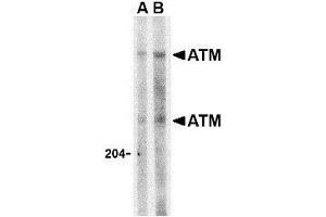 Western blot analysis of ATM in Daudi whole cell lysate with this product atM antibody at (A) 1 and (B) 2 μg/ml.