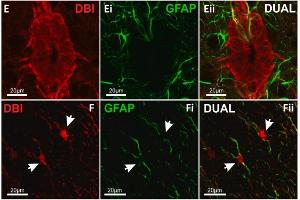 Confocal images showing labelling for DBI in ECL and GFAP+ glial fibers within lamina X of mouse spinal cord. (GFAP antibody  (AA 411-422))
