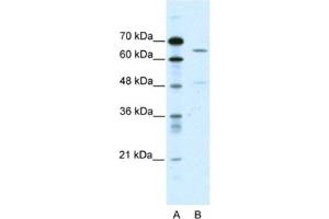 Western Blotting (WB) image for anti-Amiloride-Sensitive Cation Channel 1, Neuronal (ACCN1) antibody (ABIN2461090) (ACCN1 antibody)