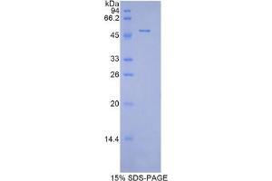 SDS-PAGE analysis of Mouse Peroxiredoxin 1 Protein. (Peroxiredoxin 1 Protein (PRDX1))