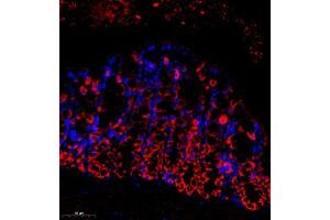Immunofluorescence of paraffin embedded mouse colon using SEC238 (ABIN7075521) at dilution of 1:650 (300x lens) (Sec23 Homolog B antibody)