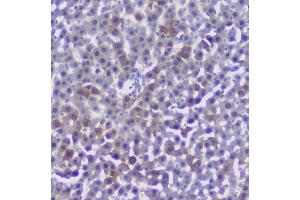 IHC analysis of CFP using anti-CFP antibody (ABIN6719298). (CFP antibody)