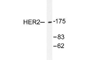 Image no. 1 for anti-Receptor tyrosine-protein kinase erbB-2 (ErbB2/Her2) antibody (ABIN265465) (ErbB2/Her2 antibody)