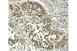 IHC analysis of Hsc70 using anti-Hsc70 antibody (ABIN7601962). (Hsc70 antibody  (AA 520-614))
