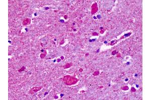Anti-CELSR2 antibody IHC of human brain, cortex, cerebellum. (CELSR2 antibody  (N-Term))
