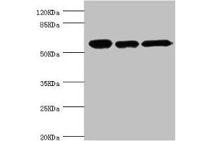Western blot All lanes: CCT2 antibody at 5. (CCT2 antibody  (AA 206-535))
