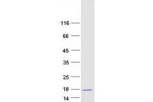 Validation with Western Blot