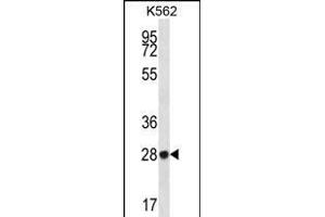ZNF146 抗体  (N-Term)