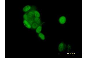 Immunofluorescence of monoclonal antibody to PGR on MCF-7 cell. (Progesterone Receptor antibody  (AA 1-110))