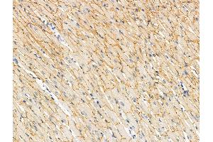 ABIN6256381 and ABIN6267092 at 1/100 staining Rat heart tissue by IHC-P. (TBC1D4 antibody  (pSer588))