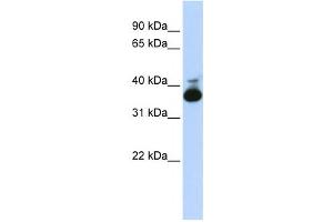 Western Blotting (WB) image for anti-Aldolase B, Fructose-Bisphosphate (ALDOB) antibody (ABIN2458580) (ALDOB antibody)