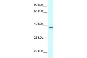 WB Suggested Anti-UPK3B Antibody Titration: 1. (Uroplakin 3B antibody  (C-Term))