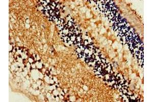 Immunohistochemistry of paraffin-embedded human eye tissue using ABIN7160169 at dilution of 1:100 (MCT3 antibody  (AA 432-504))