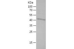 Western Blotting (WB) image for Zinc Finger, MYND-Type Containing 10 (ZMYND10) (AA 226-440) protein (His-IF2DI Tag) (ABIN7125813) (ZMYND10 Protein (AA 226-440) (His-IF2DI Tag))