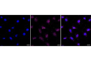 Immunocytochemical staining of HepG2 cells with FOXO1A antibody (ABIN7798644), 1:1,000).