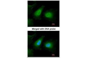 ICC/IF Image Immunofluorescence analysis of paraformaldehyde-fixed HeLa, using ULK2, antibody at 1:200 dilution. (ULK2 antibody  (C-Term))