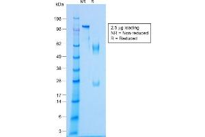 SDS-PAGE Analysis Purified NKX2. (Recombinant Nkx2-2 antibody)