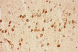 Anti-BDNF Picoband antibody,  IHC(P): Mouse Brain Tissue (BDNF antibody  (AA 129-247))