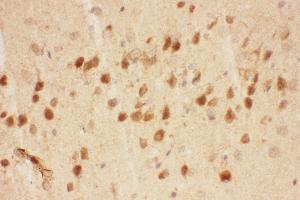 Anti-BDNF Picoband antibody,  IHC(P): Mouse Brain Tissue