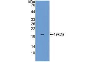 Detection of Recombinant PRDX5, Mouse using Polyclonal Antibody to Peroxiredoxin 5 (PRDX5) (Peroxiredoxin 5 antibody  (AA 49-210))