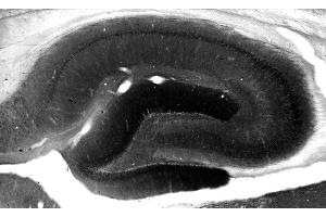 Adult rat hippocampus immunohistochemistry.