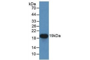 Detection of Recombinant CDNF, Human using Monoclonal Antibody to Cerebral Dopamine Neurotrophic Factor (CDNF) (CDNF antibody  (AA 33-187))