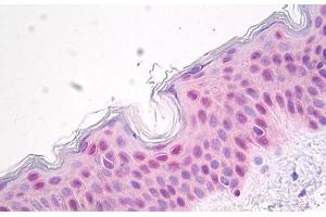 Image no. 2 for anti-Heat Shock 70kDa Protein 1A (HSPA1A) antibody (ABIN1502281)