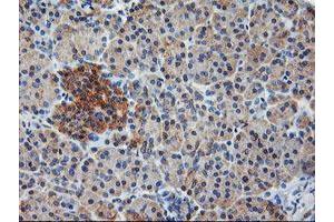 Image no. 13 for anti-IlvB (Bacterial Acetolactate Synthase)-Like (ILVBL) antibody (ABIN1498878)