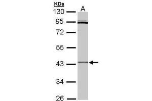 WB Image Sample (30 ug of whole cell lysate) A: Hep G2 , 10% SDS PAGE antibody diluted at 1:3000 (CRLF1 antibody)