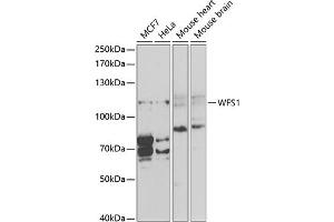 Western blot analysis of extracts of various cell lines, using WFS1 antibody (ABIN3022419, ABIN3022420, ABIN1513689, ABIN1514834 and ABIN6218806) at 1:1000 dilution. (WFS1 antibody  (AA 1-285))