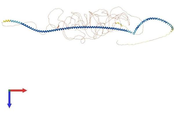 MTUS1 Protein (AA 1-1270) (His tag)