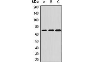 Western blot analysis of ALPPL2 expression in SKOV3 (A), HepG2 (B), mouse testis (C) whole cell lysates. (ALPPL2 antibody)