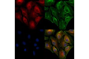 ABIN7094891 and ABIN7098944 staining  cells by IF/ICC. (PAG1 antibody  (Internal Region))