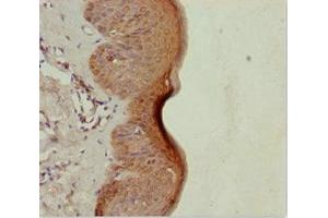Immunohistochemistry (IHC) image for anti-Leucine Rich Repeat and Sterile alpha Motif Containing 1 (LRSAM1) (AA 1-290) antibody (ABIN7151057)