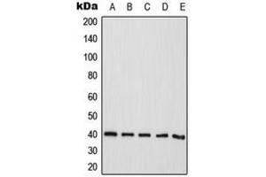 Western blot analysis of CD298 expression in HeLa (A), Jurkat (B), A431 (C), Raw264.