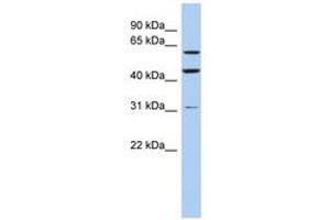 Image no. 1 for anti-Ring Finger Protein 112 (RNF112) (AA 466-515) antibody (ABIN6742431) (RNF112 antibody  (AA 466-515))