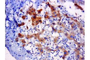 Paraformaldehyde-fixed, paraffin embedded rat liver cancer, Antigen retrieval by boiling in sodium citrate buffer (pH6. (C5orf51 antibody)