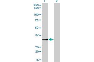 Western Blot analysis of BLVRA expression in transfected 293T cell line by BLVRA monoclonal antibody (M01), clone 4G4-2B6. (Biliverdin Reductase antibody  (AA 1-296))