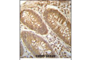 PG Antibody (N-term) (ABIN657272 and ABIN2846364) immunohistochemistry analysis in formalin fixed and paraffin embedded human colon tissue followed by peroxidase conjugation of the secondary antibody and DAB staining. (PGAM4 antibody  (N-Term))
