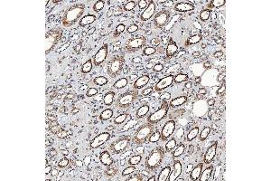 IHC analysis of SETD3 using anti-SETD3 antibody (ABIN7600293). (SETD3 antibody  (AA 173-468))
