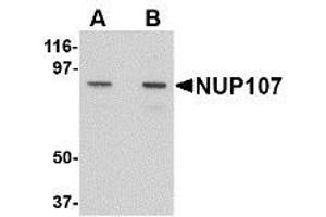 Image no. 1 for anti-Nucleoporin 107kDa (NUP107) (C-Term) antibody (ABIN342686) (NUP107 antibody  (C-Term))