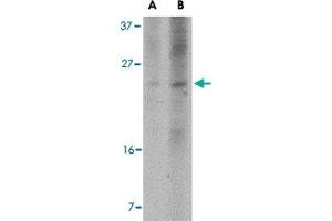 Western blot analysis of BBC3 expression in K-562 cell lysate with BBC3 monoclonal antibody, clone 10C5G1  at (A) 2. (PUMA antibody  (AA 76-170))
