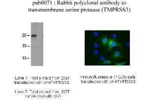 Image no. 1 for anti-Transmembrane Protease, Serine 3 (TMPRSS3) antibody (ABIN347032) (TMPRSS3 antibody)