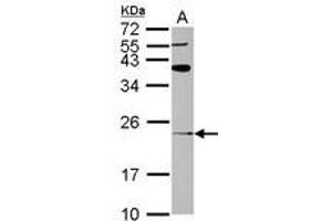 Image no. 1 for anti-ADP-Ribosylation Factor-Like 8A (ARL8A) (AA 1-186) antibody (ABIN1496722) (ARL8A antibody  (AA 1-186))