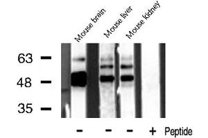 Western blot analysis of CKMT2 Antibody expression in mouse brain, mouse liver and mouse kidney tissues lysates.