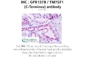 Image no. 1 for anti-G Protein-Coupled Receptor 137B (GPR137B) (C-Term) antibody (ABIN1734939) (GPR137B antibody  (C-Term))