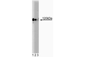 Western blot analysis of PRK1 on Jurkat lysate. (PKN1 antibody  (AA 215-388))
